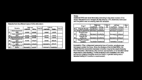 Mild Cone Dystrophy - CRX Mutation
65 year old  female with minimal symptoms and a mild cone dystrophy.
