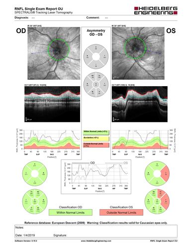 Grade 4 hypertensive retinopathy
55 year old man Hhe did have headaches a few weeks ago and also some nausea and vomiting.  He noticed for a few weeks the vision in the left eye was blurred and  that the vision in the left eye is dark.  
VA OD: Dcc20/20 
VA OS: Dcc20/100-1

He was admitted directly to ICU for blood pressure control (290 / 170 mmHg)
3 weeks later his VA increased to 20/20 OD, 20/32 OS
