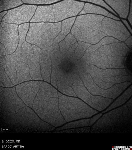 Normal Autofluorescence
