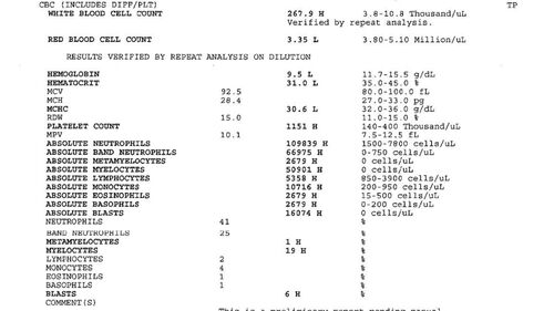 Chronic Myelogenous Leukemia and Diabetic Macular Edema
71 year old female with 3 months of vision loss and not feeling well.  She has been bruising on her legs.  Her vision was 20/100 in each eye with macular edema.  She was treated with Avastin and her CBC was checked.  She had a WBC of 267 thousand and was diagnosed with CML.
