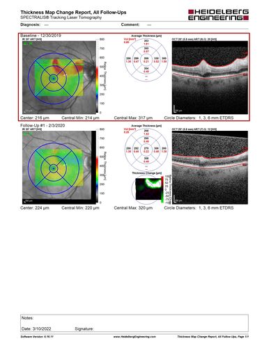 cilioretinalarteryocclusion_dosih_20191230_16.JPG