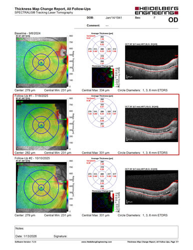 Peripapillary CNVM No Treatment
85 year old with peripapillary CNVM watched for many years.

