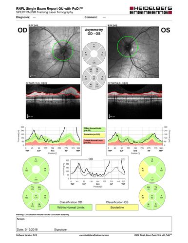 Multifocal Choroiditis - Pneumocystis - aspergillis - cryptococcus
31 year old male with anaplastic astrocytoma on chemotherapy with mild vision loss in the right eye.  LP did not reveal organism.  He was placed on a trial of anti-fungal medications and lost to follow-up
