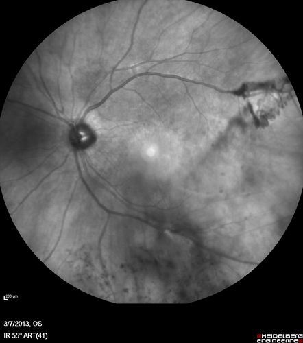 PDR - IR
