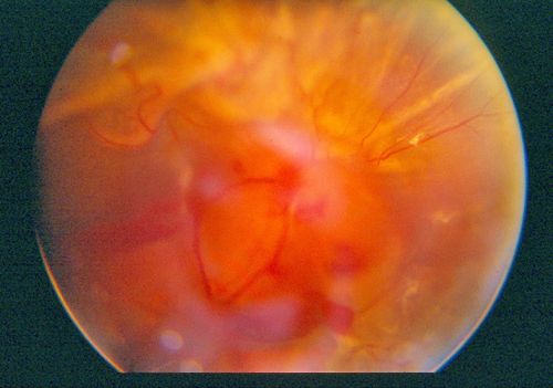 trd10preop_28229.jpg