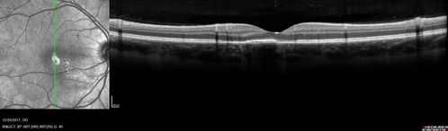 uaim2_brma_122017_000.jpg