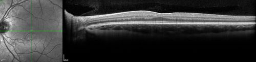 wyburn_aldo_011916_15.jpg