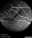 Angioma_litom_051121_10.jpg