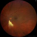 BRVO_NVE_hacar1_071221_prelaser02.jpg