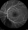 BRVO_NVE_hacar1_071221_prelaser07.jpg