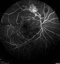BRVO_NVE_hacar1_071221_prelaser08.jpg