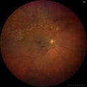 BRVO_NVE_hacar2_071221_postlaser15.jpg
