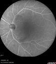 CME_Chemo_125315_032025_11.jpg