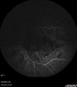 CRVO_jomer_060623_15.jpg