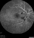 CWS_postAorticDissection_125569_060625_11.jpg