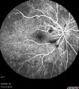 CWS_postAorticDissection_125569_060625_12.jpg