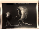 Choroidals_hypotony_03.jpg