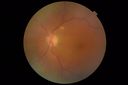 Chronic-endo_macro_020619_0004.JPG