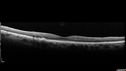 Chronic-endo_macro_020619_0007.jpg
