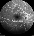 Chronic-endo_macro_020619_0016.jpg