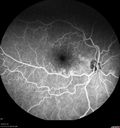 Chronic-endo_macro_020619_0017.jpg