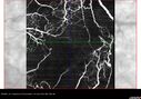 DR-Macular-Ischemia_126599_080825_24.jpg