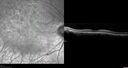 Dystrophy-genenegative_arfer_040821_04.jpg