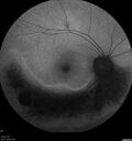 Dystrophy-genenegative_arfer_040821_13.jpg