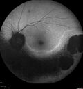 Dystrophy-genenegative_arfer_040821_18.jpg