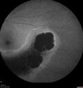 Dystrophy-genenegative_arfer_040821_20.jpg