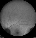 Dystrophy-genenegative_arfer_040821_21.jpg