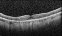 Elmiron_120641_062824_14.jpg