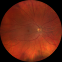 Heterochromia_jehay_080519_01.png
