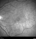 LamellarMH_114951_041823_06.jpg