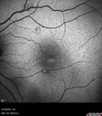 LamellarMH_114951_041823_08.jpg