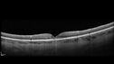 LamellarMH_114951_041823_10.jpg