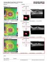 Neuroretinitis_gwcal_081221_17.JPG