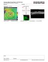 Neuroretinitis_gwcal_081221_18.JPG