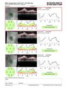 Neuroretinitis_gwcal_081221_19.JPG