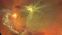 PDR-TRD_chlaw1_12302019_04.png