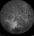 PDR-VA1_adadk_072820_18.jpg