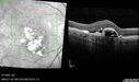 PED-cholesterol_elsup_022022_15.jpg