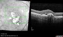 PED-cholesterol_elsup_022022_16.jpg