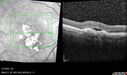 PED-cholesterol_elsup_022022_18.jpg