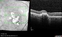 PED-cholesterol_elsup_022022_21.jpg