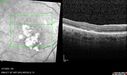 PED-cholesterol_elsup_022022_28.jpg