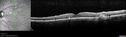 POHS_ancer_061617_11.jpg