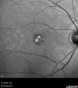 PatternDystrophy_96645_063022_05.jpg