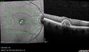 PatternDystrophy_96645_063022_15.jpg