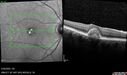 PatternDystrophy_96645_063022_17.jpg